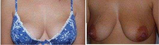 tetas.jpg