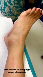 Carlota-Boza-Feet-8120204.jpg