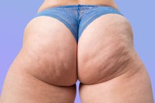 187653026-muslo-con-sobrepeso-mujer-con-caderas-gordas-y-nalgas-cuerpo-femenino-obeso-con-celu...jpg