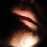 MORBOSO2
